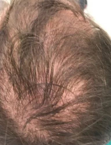 20181104_100023-820x500